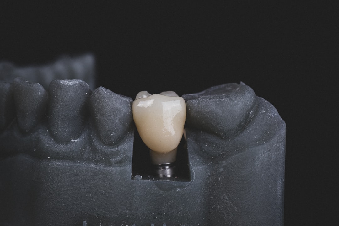 Smile Detail