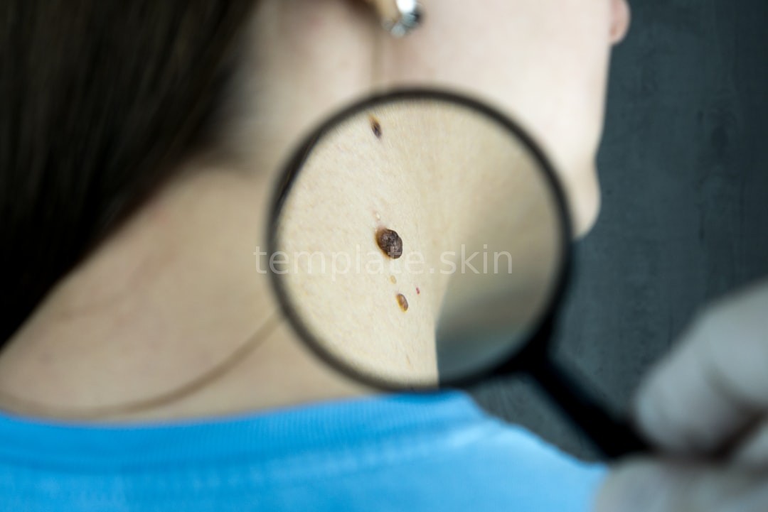 Aesthetic Treatments