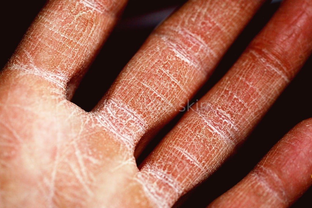 Skin Wellness